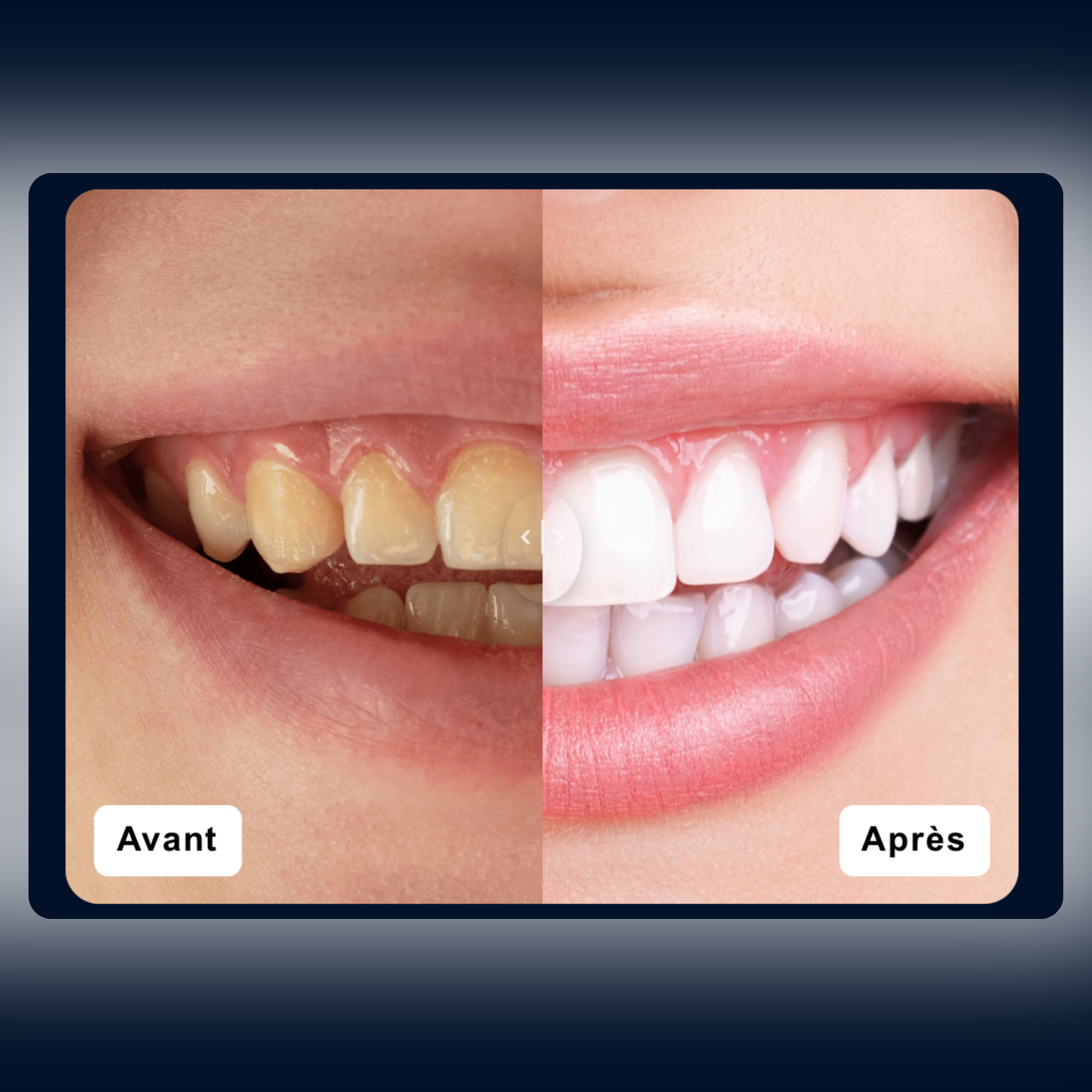 N°37|Avant / Après